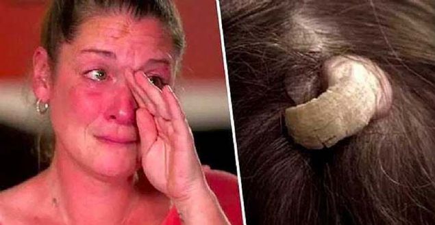 Bu insanları gördüğünüzde inanmakta güçlük çekeceksiniz... <br><br> 43 yaşındaki, bir çocuk annesi Lisa'nın cildinde bir şişlik meydana geldi. Yaklaşık bir yıldır kafasının arka kısmında beliren bu şişliği gergedan boynuzuna benzetiyordu.