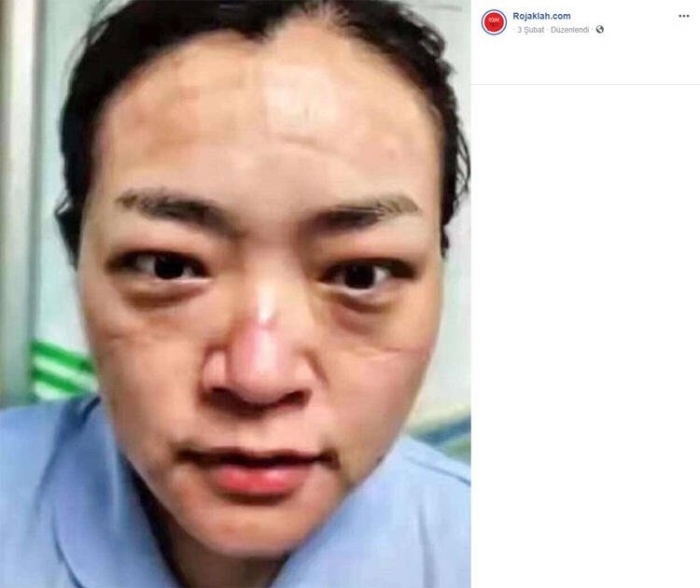                                                                 in'de salk ekiplerinin haftalardr evlerine gidemedii ve ailelerini gremedii belirtiliyor. inli doktorlarn aileleri hastanenin dna ardklar salk alan yaknlarn uzaktan grp temas kurmadan evlerine geri dnyor.                                                      