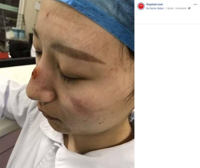                                                                 Ekiplerin virse maruz kalmamak adna kullanmak zorunda olduklar, zel giysiler ve maskelerin arl da i ykne daha da zorlatryor. Btn gn yzlerinden karamadklar maskeler alanlarn yzlerinde derin izler brakyor.                                                      