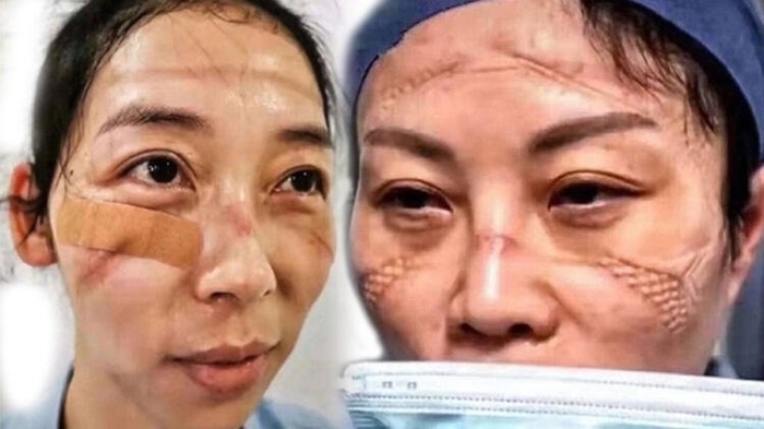                                                                 Virsten etkilenenlerin says, 3 bin 859'unun durumu ciddi olmak zere 28 bin 18, durumu pheli olanlarn says ise 24 bin 702 olarak aklanrken, mahade altna alnanlarn says da 186 bin 354'e ulat.                                                      