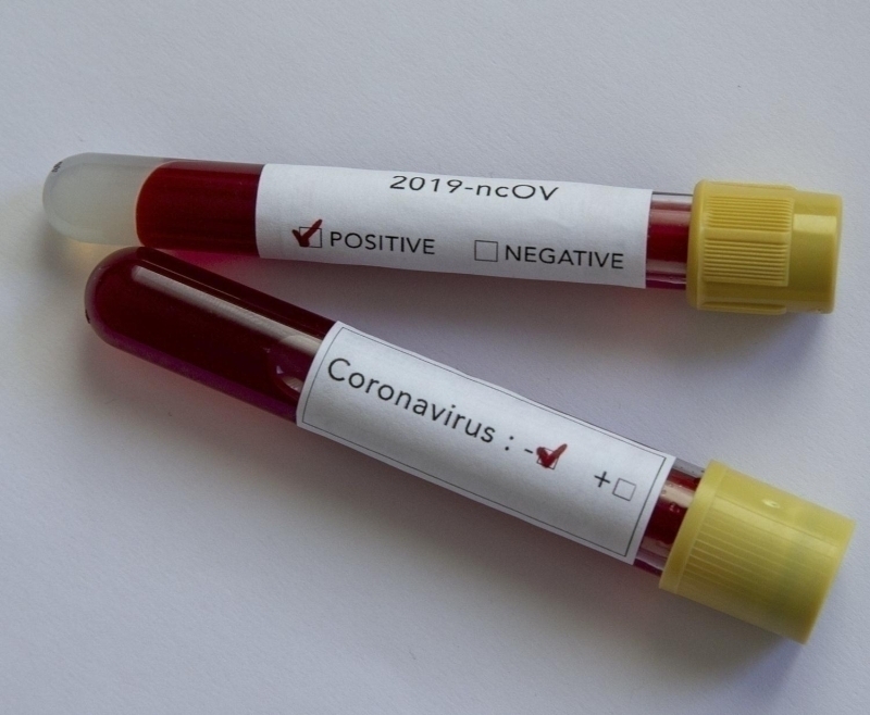 Coronavirs uana dek 30 lkeden fazla yerde grld. Hastaln yayld corafyaya bakldnda daha ekvator kuanda olan yani scak iklimde bulunan lkelerde de virs var.  Peki bu durum bize ne anlatyor? “uan da yaz olan gney yarm krede yani Avusturalya ktasnda virs var. Demek ki virs bu scak havalarda da yaayabiliyor” diyen Prof. Dr. Akkoyunlu, “Fakat biliyoruz ki bunlarda genelde ikincil temasa bal, yani hastaln bulunduu bir yerden temasla gelen hastalklar. Yani o blgede ikinci bir kiiye bulamad, bu da bir umut olarak ortaya kyor” eklinde konutu. 