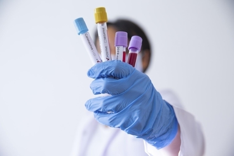 Dnya Salk rgt virsten korunmak iin u tavsiyelerde bulunuyor: •	Ellerinizi ykayn - sabun veya el temizlik jelleri virs ldrebilir •	ksrrken veya haprrken aznz ve burnunuzu mendille kapatn ve sonrasnda virsn yaylmasna engel olmak iin ellerinizi ykayn •	Gzlerinize, burnunuza ve aznza dokunmaktan kann - elleriniz virsn dedii bir yere dokunursa virs vcudunuza bulaabilir •	ksren, hapran veya atei yksek kiilerden uzak durun - 1 metre uzak durmak havaya bulaabilecek virsten korunmanz salar 