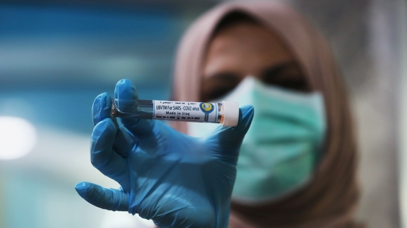 <p>İran (64 bin 586), İngiltere (60 bin 733), Türkiye (38 bin 226), Belçika (23 bin 403), İsviçre (23 bin 248), Hollanda (20 bin 549), Kanada (19 bin 195), Brezilya (15 bin 927), Portekiz (13 bin 141), Avusturya (12 bin 941) ve Güney Kore (10 bin 384) vaka var.</p>