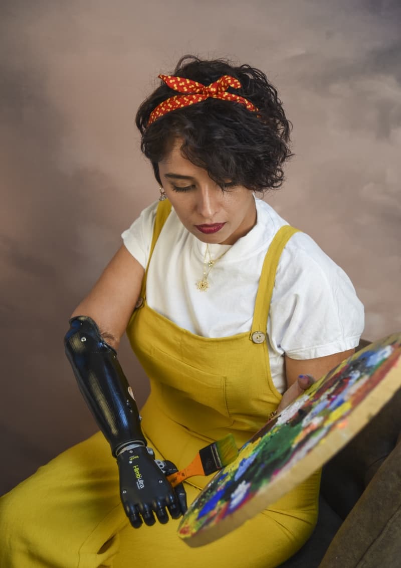 <p>Bir�ok insan i�in 'katlan�lmaz' diye nitelendirilen travmalara ra�men hayata her ge�en g�n daha s�k� ba�lanan Nisa Karabacak, yakla��k 3 y�l �nce kendi tabiriyle 'Hayat �imdi ba�l�yor.' diye nitelendi�i d�nemde biyonik koluyla tan��t�.</p>