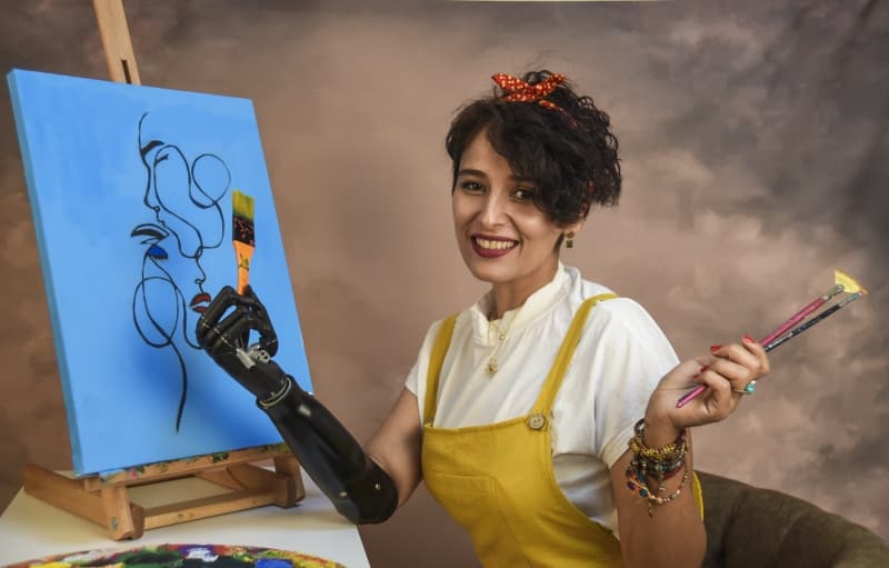 <p>Art�k hayat�n�n bir par�as� haline gelen koluna 'Revo' ismini veren Karabacak, ilk ba�larda sadece ev i�lerini yapabildi.</p>