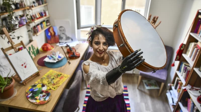 <p>�u an protezle biraz a��lar konusunda zorlan�yorum ama buna uyumlu yeni bir protez yapabilmek i�in �al��malara da ba�lad�k.<br></p>