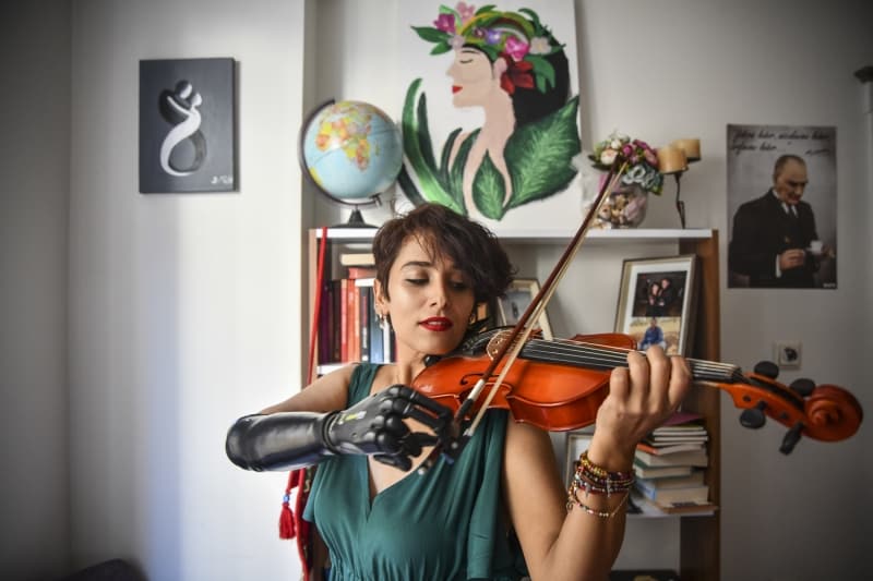 <p>D�nyada �ok az say�da bile olsa protezle keman �alabilen insan var ��nk�.</p>