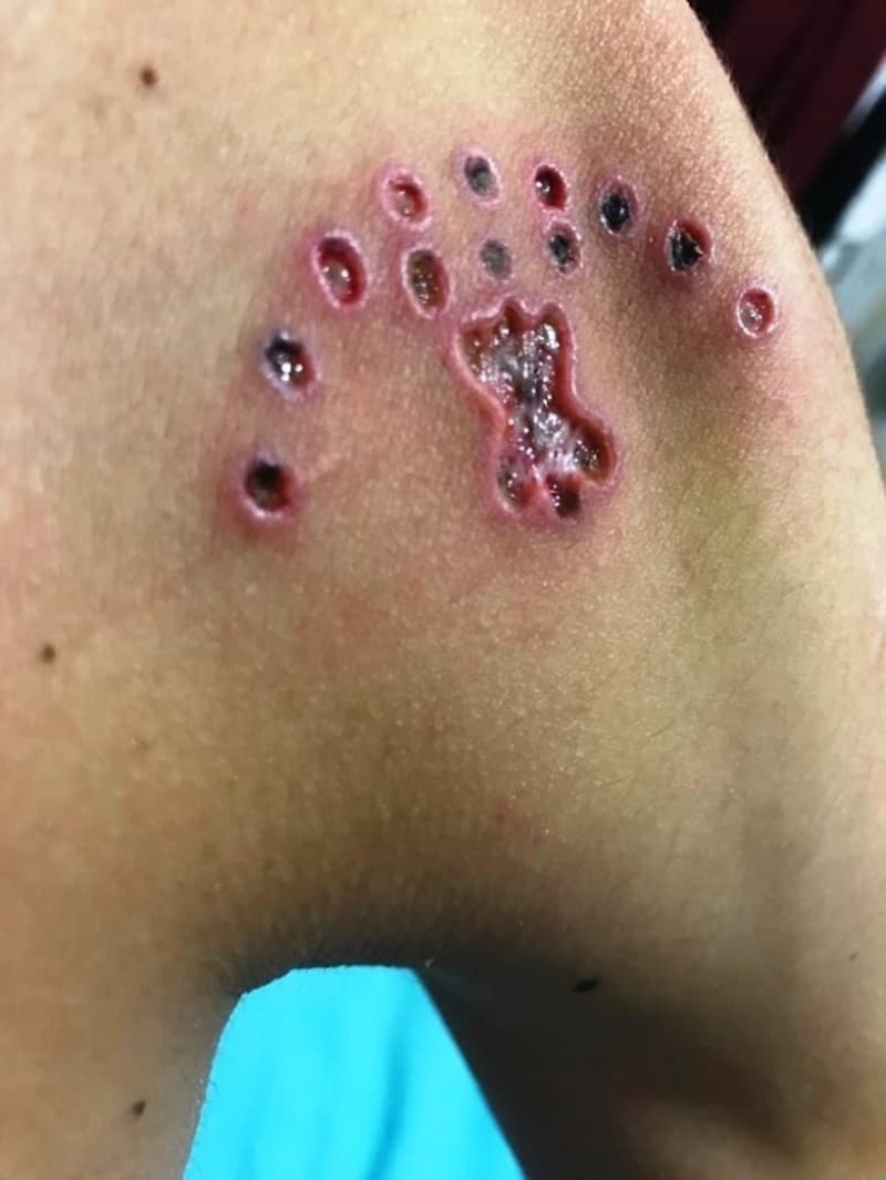 <p>Y�ld�zel, hayat�n� kabusa �eviren estetik uzman� hakk�nda ise �ikayet�i oldu.</p>