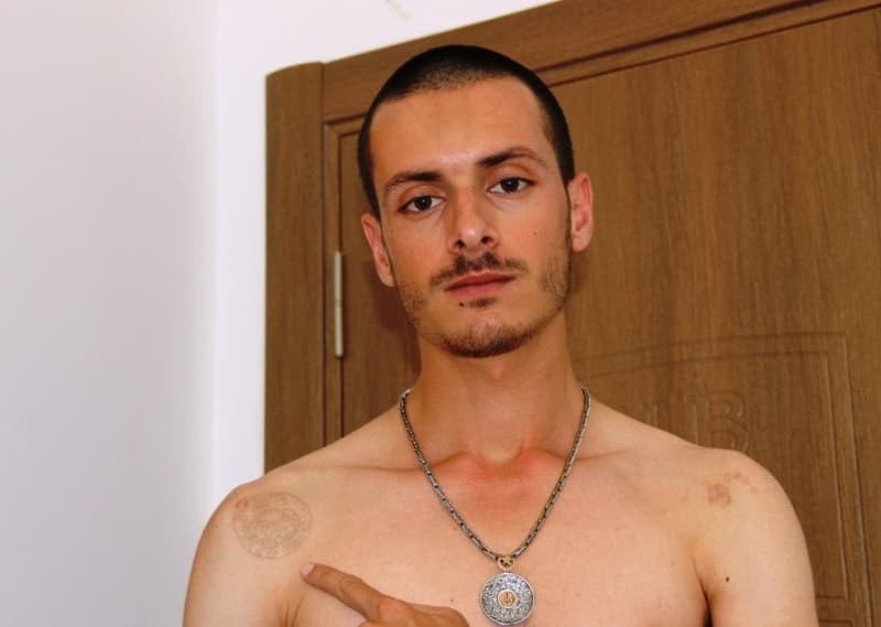 <p>Hayalleri i�in sildirmek istedi�i d�vmeleri gencin kabusu oldu. Birka� estetik uzman� ile g�r��en Y�ld�zel’e verilen cevaplar ayn� olunca �ocuklu�undan beri asker olma hayalleri de suya d��t�. Gen� adam k�t� bir g�r�nt� olu�turan kollar� nedeniyle uzun kollu k�yafetlerle gezmeye ba�lad�.</p>