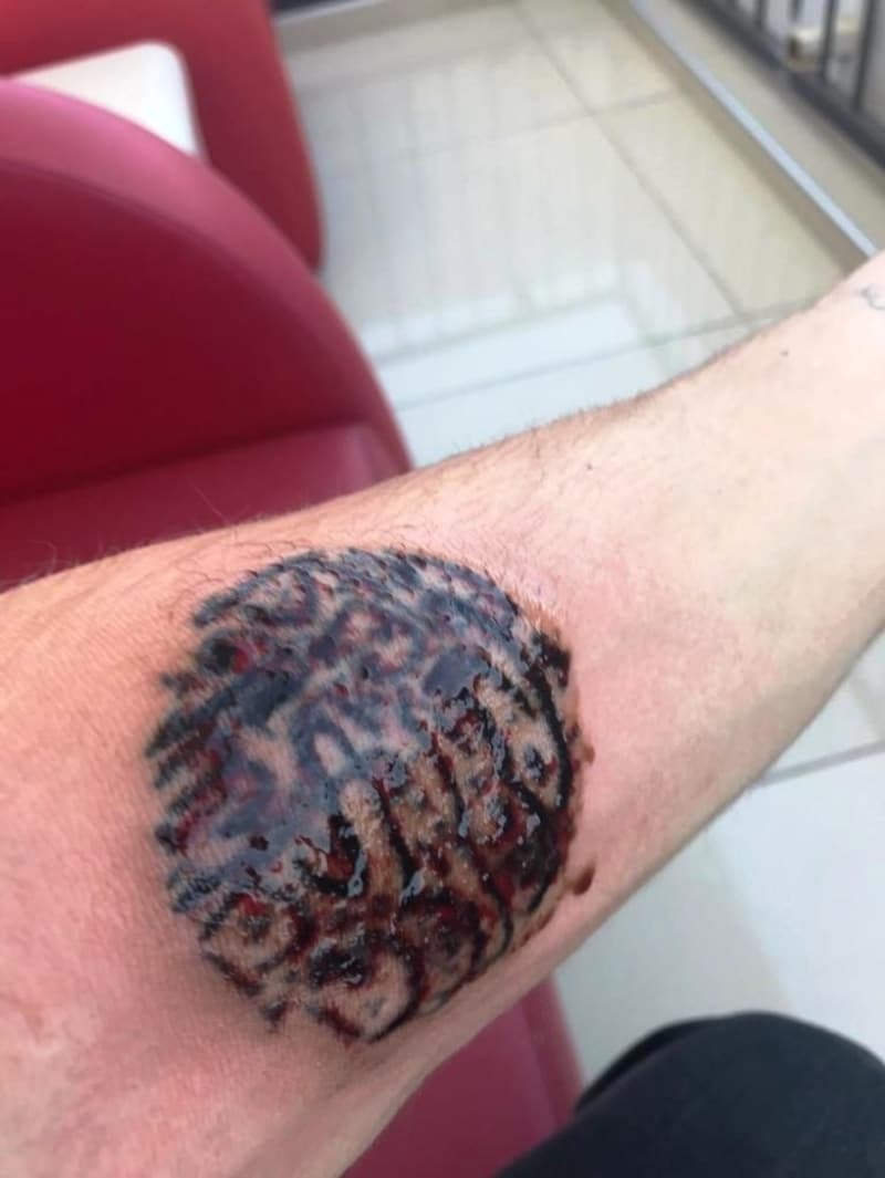 <p>Bu i�lemlerin ard�ndan ben ba�ka bir doktora gittim ve bu i�lemlerin ge�meyece�ini orada ��rendim. Ve beni bu zamana kadar oyalad���n� ��rendim. Bu i�lemler ba��nda bana bunlar yans�t�lsayd� ben ba�ka bir doktora giderdim.&nbsp;</p>