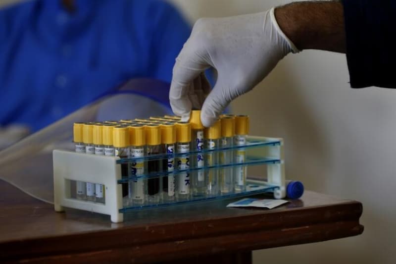 <p class='MsoNormal'>Virologlar da D614G mutasyonuna sahip virüslerin, bu  mutasyona sahip olmayanlardan daha bulaşıcı olduğunu tespit ettiklerini  söylemişti.</p>