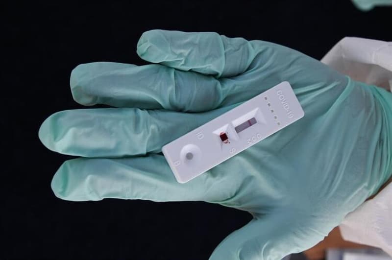 <p class='MsoNormal'>Peki D614G mutasyonu aşı çalışmalarını etkileyecek mi? Bu en  kritik sorulardan biri olmaya devam ediyor.</p>