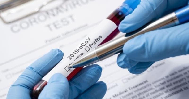 <p>Gnlk koronavirs illere gre vaka says verileri Salk Bakanl'nn internet sitesinden paylald. Son paylalan verilere gre, Bir nceki gne gre blgelerdeki yeni vaka deiim yzdesine bakldnda; en fazla azal Dou Marmara Blgesinde gereklemitir (-%9,0). En fazla art ise stanbul Blgesinde olup vaka says asndan incelendiinde bu fark 61 vakadr.</p>