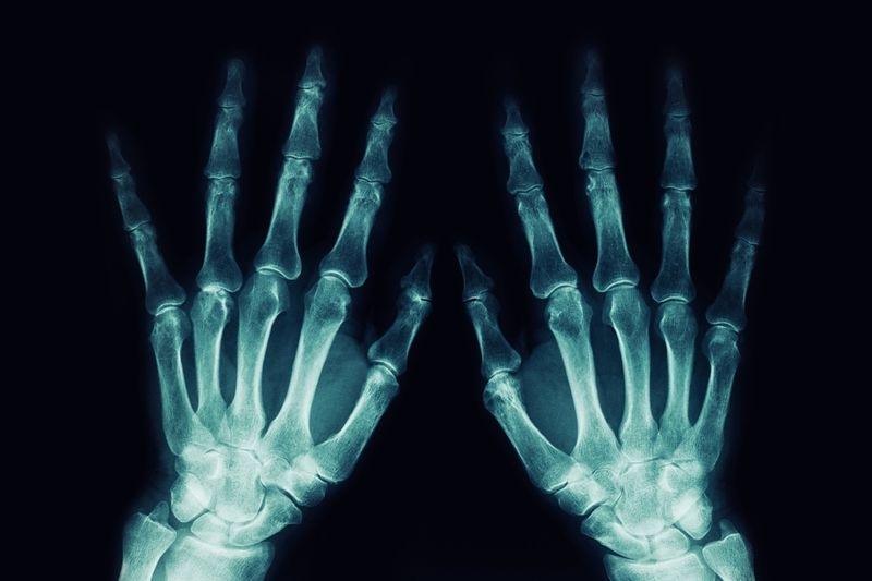 <p><b>X-Ray Işını</b></p><p>Wilhelm Conrad Rontgen (1895)<b><br></b></p>