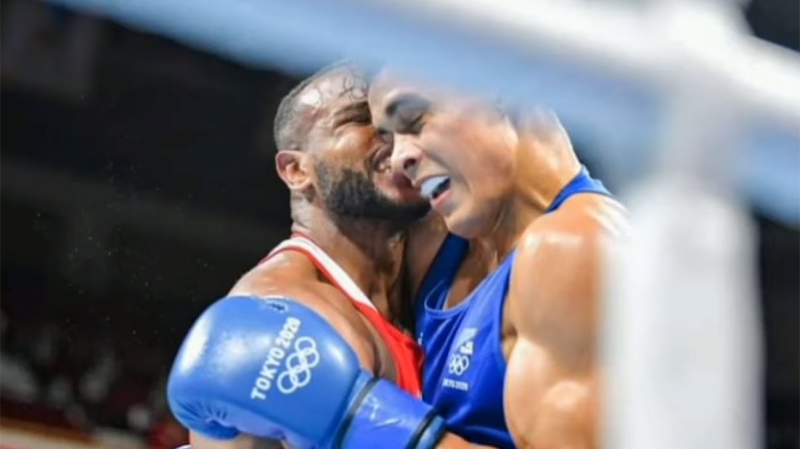 <p>Son anda kafasını kaçıran Nyika ise bu eylemden fiziksel zarar görmeden kurtuldu.</p>