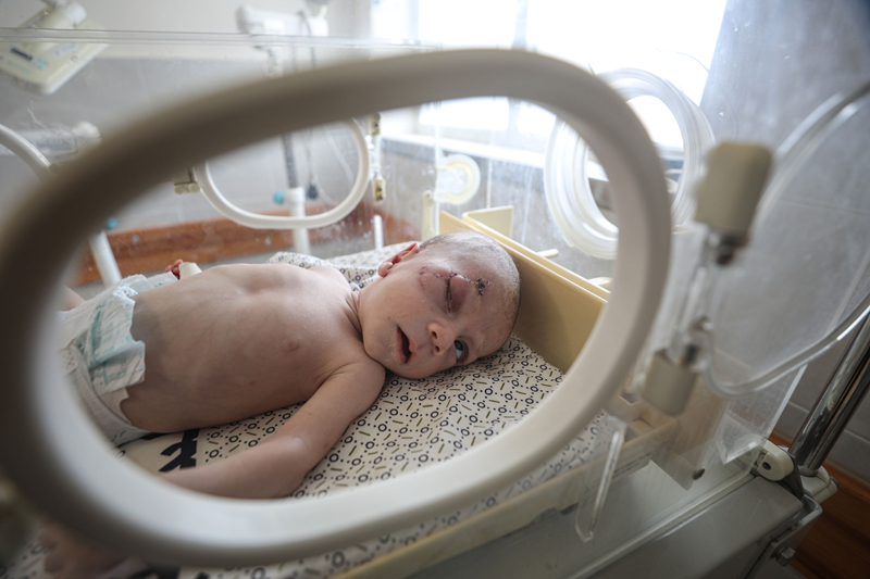 <p>Filistin Kzlay, srail ordusunun baskn ve saldrlar nedeniyle hizmet vermeyi durduran Gazze'nin kuzeyindeki ifa Hastanesi'ndeki 31 prematre bebei dn Gazze'nin gneyindeki Emirlik Hastanesi'ne naklettiklerini duyurmutu.</p>