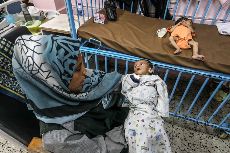 <p>Nasır Hastanesi Pediatri Bölümü Başkanı Doktor Ahmed el-Ferra, Rama ve Sila bebekle ilgili bilgi verdi.</p>