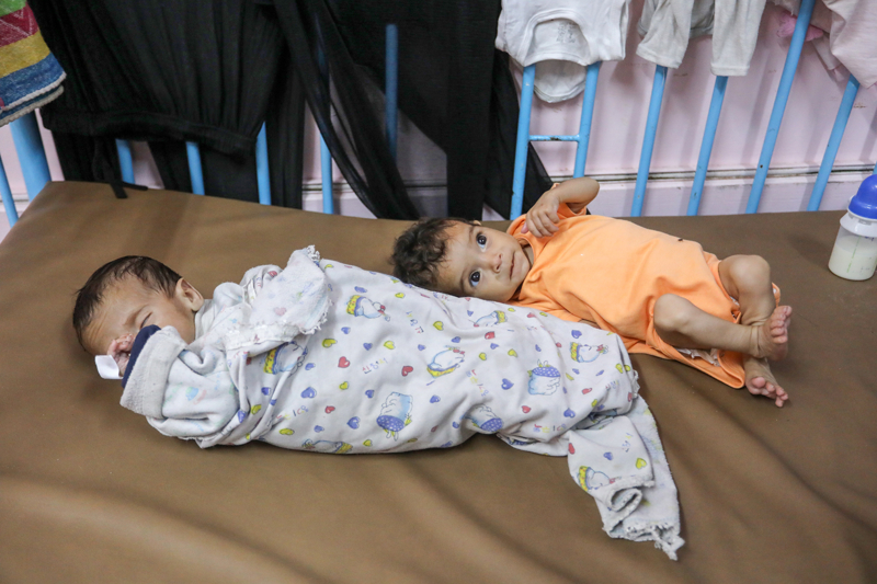 <p>Ferra, 10 kilo olması gerekirken 4 kilo ağırlığında olan 11 aylık Sila'nın da vücut kitlesinin yüzde 60'ını kaybetmiş durumda olduğunu ifade etti.</p>