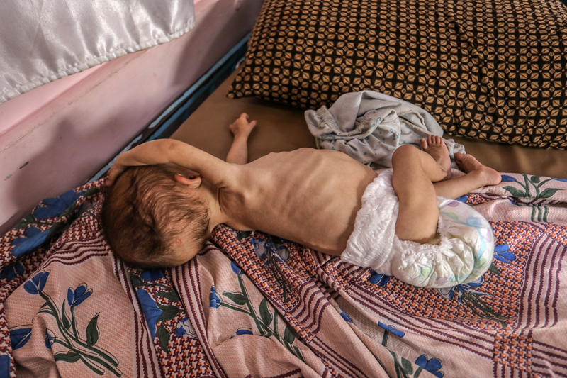 <p>Barbah, 'Her gece 3-4 kez kalkıp kızımın yaşayıp yaşamadığını kontrol ediyorum. Allah'ım uyandığımda onu yanımda bulayım diye dua ediyorum. Ağlasın ama yeter ki sesi çıksın ve yaşasın. Bu hastane odasındaki çocuklardan çoğu açlıktan öldü. 80 çocuk açlıktan öldü, kızımın 81. olmasından korkuyorum.' dedi.</p>