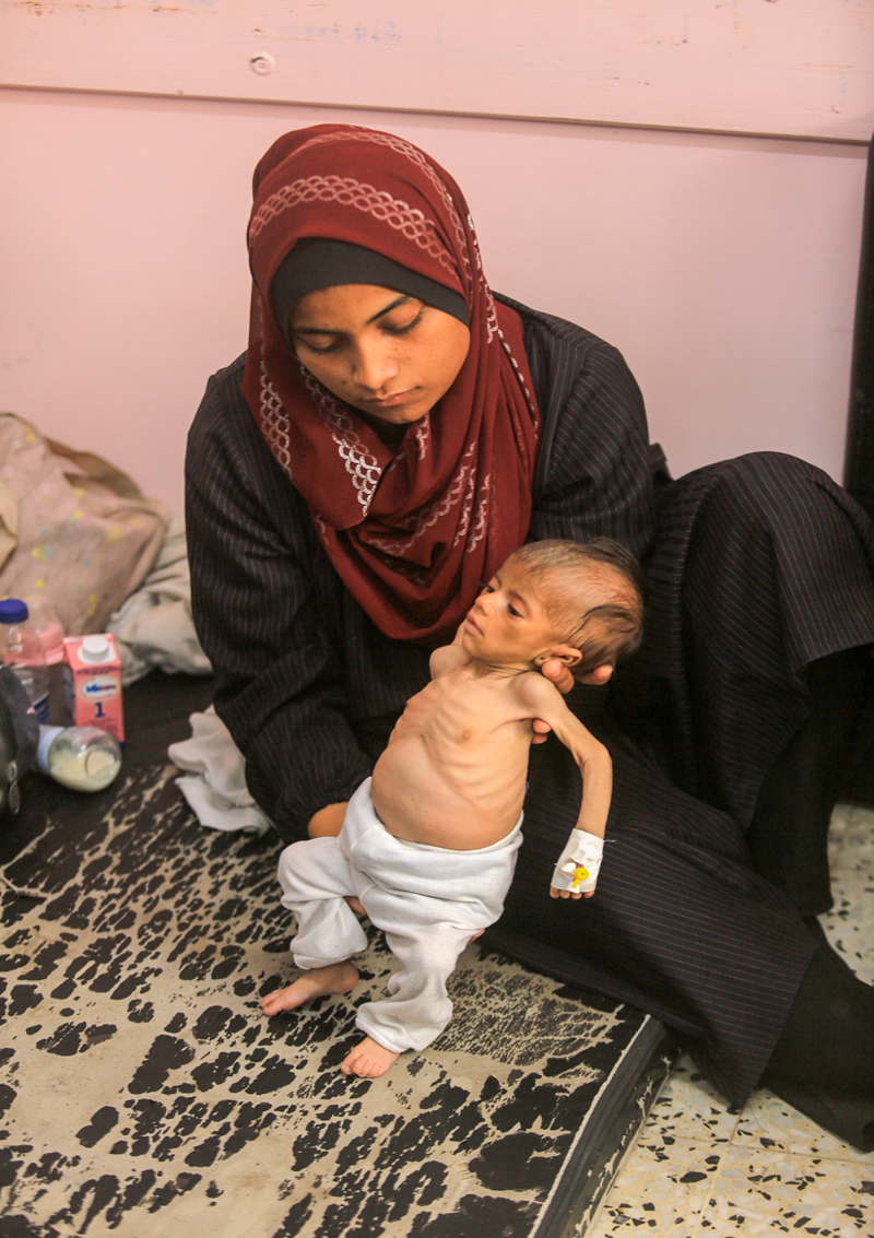 <p><p></p></p><p><b>'ÇOCUKLARIN ÖLÜMÜNE DAHA NE KADAR SEYİRCİ KALACAĞIZ'</b></p><p><b><br></b></p><p>Aksa Şehitleri Hastanesi'nde tedavi gören 5 aylık Emir el-Kilani ile 1 yaşındaki Muhammed Avvad da yetersiz beslenme nedeniyle ölüm riski altında.</p>