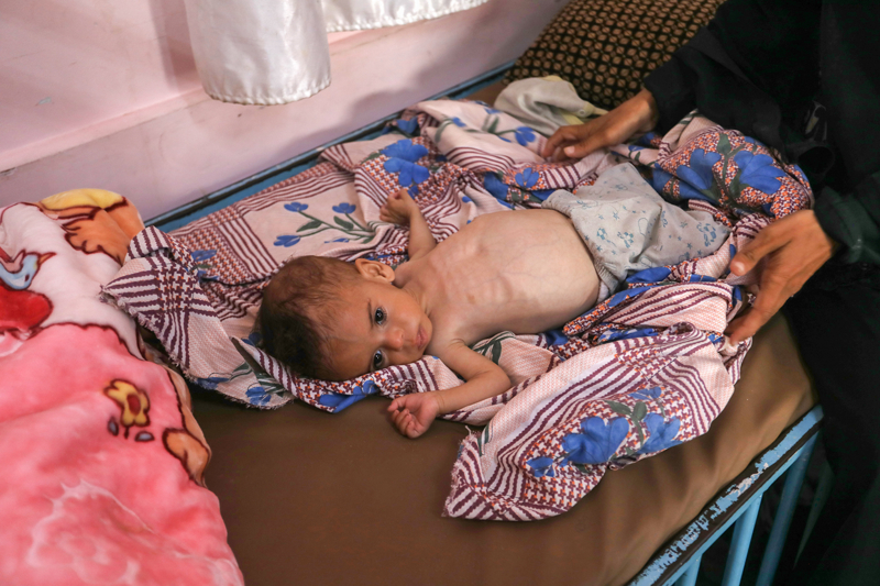 <p>Yaklaşık 3 aydır, oğlunun kilo alması için mama aradıklarını ama bulamadıklarını söyleyen Amine 'Çocuklar her gün gözümüzün önünde ölüyor ve biz seyrediyoruz. Bu daha ne zamana kadar böyle sürecek.' diye sordu.</p>