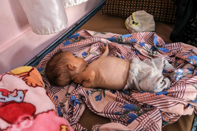 <p>Emir'in annesi Riham el-Kilani, oğlunun kaslarındaki zayıflık nedeniyle kasılmaları olduğunu ve bu yüzden hastanede olduklarını belirtti.</p>