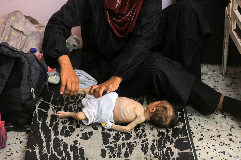 <p>Muhammed Avvad'ın annesi Amine Avvad ise oğlunun yetersiz beslenme ve akut ishal sorunu yaşadığını kaydetti.</p>