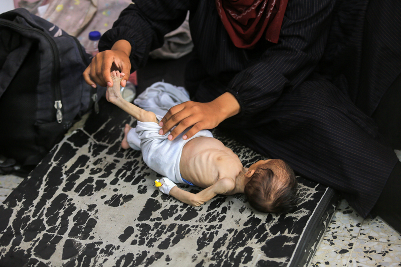 <p>Anne Amine artık çocuklar gibi yetişkinlerin de yetersiz beslenme sorunu yaşadığını, insanların halsizlikten sokaklarda yerlere serildiğini ve hastanenin yetersiz beslenme sorunu yaşayan insanlarla dolu olduğunu sözlerine ekledi.</p>