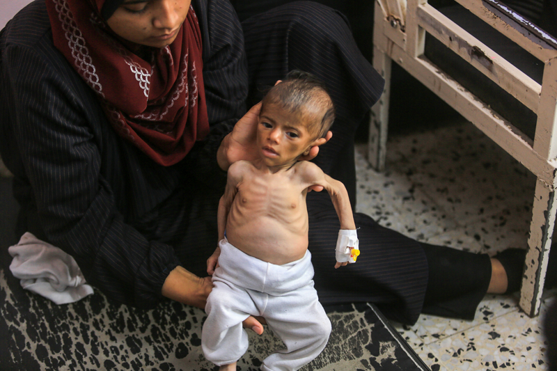 <p>Gazze'de İsrail saldırılarının başladığı 7 Ekim 2023'ten bu yana 81'i çocuk olmak üzere 111 kişi açlık ve yetersiz beslenmeden nedeniyle hayatını kaybetti.</p>