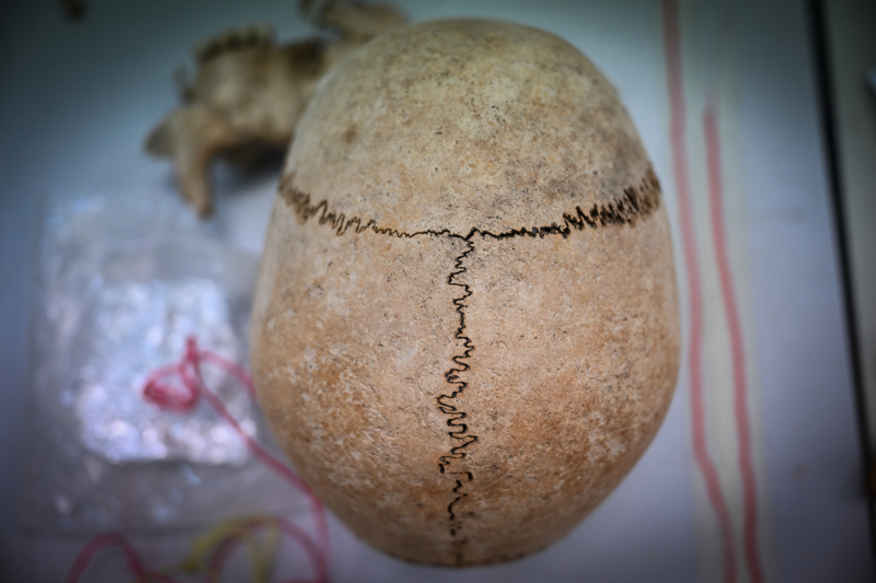 <p>K�lt�r ve Turizm Bakanl���n�n izniyle, �anakkale Onsekiz Mart �niversitesi M�zecilik B�l�m� ��retim �yesi Do�. Dr. Sava� Sar�altun ba�kanl���nda, Hacettepe �niversitesi Antropoloji B�l�m� ��retim �yesi Prof. Dr. �m�r Dilek Erdal koordinasyonunda alan�nda uzman arkeolog ve antropologlar�n kat�l�m�yla 2025 y�l�n�n may�s ay�nda ba�layan kaz�lar�n ge�en sezonki etab� aral�k ay�nda tamamland�.</p>