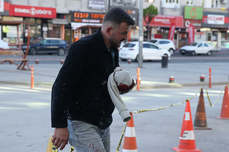 <p>Kendini yaralayan Mustafa Durak, 'Hayvan kesimi yaparken hayvan çırpındı. Bıçak elimden kaydı ve baldırıma saplandı' dedi. </p>