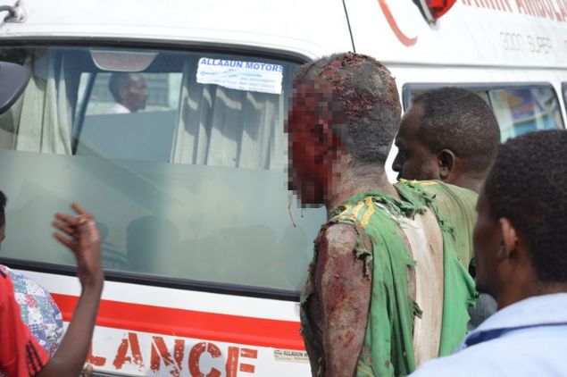 AP'nin ge�ti�i habere g�re, y�zba�� Muhammed H�seyin yapt��� a��klamada, 'Sabah�n erken saatlerinde sald�r�n�n yap�ld��� Mogadi�u'daki Dayah isimli otelde milletvekilleri de dahil olmak �zere onlarca ki�inin kald��� d���n�l�yor' dedi. 