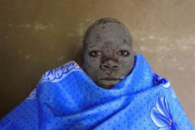 Kenya'n�n bat�s�nda yer alan Bungoma'da Luhya kabilesi'na ait Bukusa halk�n�n erkek �yelerinin her y�l�n A�ustos ay�nda yapt�klar� bir gelenek var.     