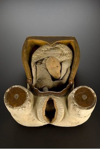 Do�um Fantomu  �talya'da 18. y�zy�lda bebeklerin nas�l do�du�unu t�p ve ebelik e�itimi alanlara ��retmek i�in kullan�l�rd�. 