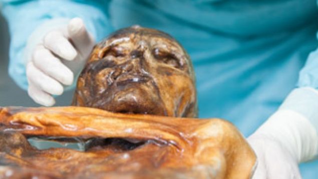 Bir ba�ka dikkat �ekici kan�t, �l�m�nden iki g�n �nce elinden ald��� yarayd�. �tzi, b�y�k ihtimalle bir kavgaya kar��m��t�. Bu, klasik bir aktif savunma yaras�na benziyordu. �rne�in biri sizi b��aklamaya �al��t���nda b��a�� tutarak itmeye �al��t���n�zda ald���n�z yara gibi.     