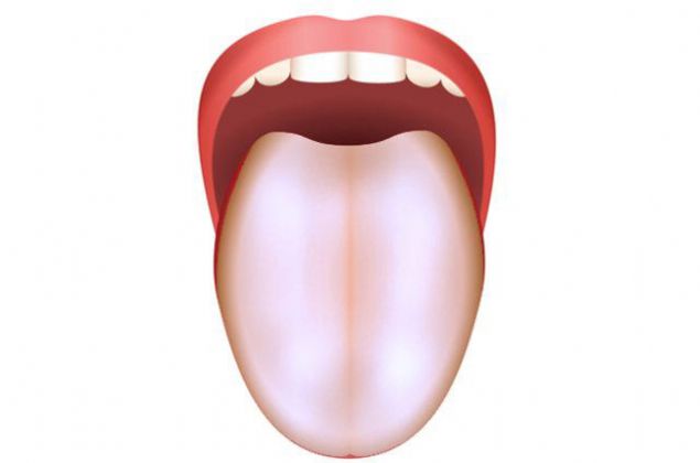                                                                     Dilde sararmann yan sra dirsekler, dizler, eller ve ayaklarda da sar renk grlr. Bu belirtiler ise yksek kolesterol seviyesini iaret edebilir.                                                          