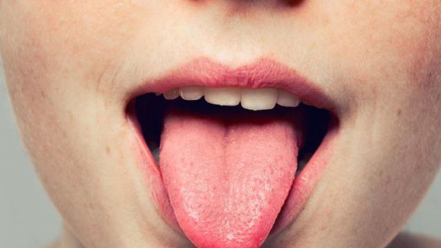                                                                     Vitiligo ad verilen bu hastalkta eller, ayaklar, yz ve dudak renginde koyulamalar meydana gelir.                                                           