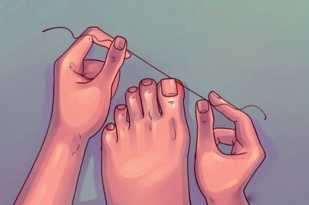       Ardndan temiz bir di ipini trnanzn altna yerletirin ve yavaa ipi yukarya doru kaldrn. Bylelikle batan trnak parmanzdan kacaktr. Ardndan trnak batmasyla oluan yarann gemesi iin blgeye antiseptik bir krem srn ve parmanz korumak iin parmanz bandajlayn.  