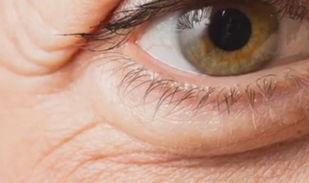             Gz altnza srn ve fark grn...  