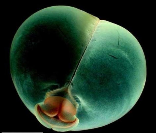    Pigbutt solucan: Bu havyann domuz poposunu andran ekli sebebiyle ismi 'Pigbutt' konulmutur. Okyanus yzeyinin yaklak 1 km altnda yaarlar.  