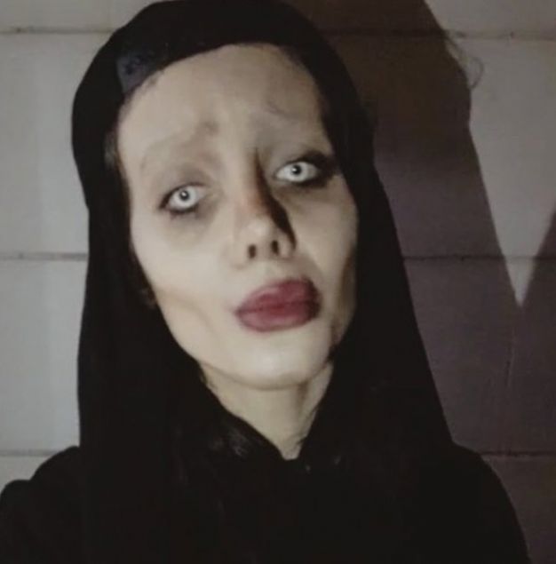  Ard�ndan �st �ste estetik operasyonlar ge�iren �ranl� kad�n�n son halini g�ren Instagram kullan�c�lar� ��nsanl�ktan ��km��' yorumlar� yapt�. 