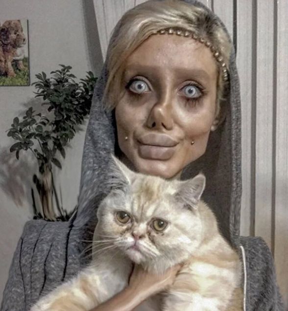  �st �ste estetik operasyonlar ge�iren �ranl� kad�n�n son halini g�renler �a�k�nl���n� gizleyemedi. 