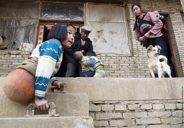  Qiann ailesinin maddi durumu kt olduundan ona protez de alamadlar.     