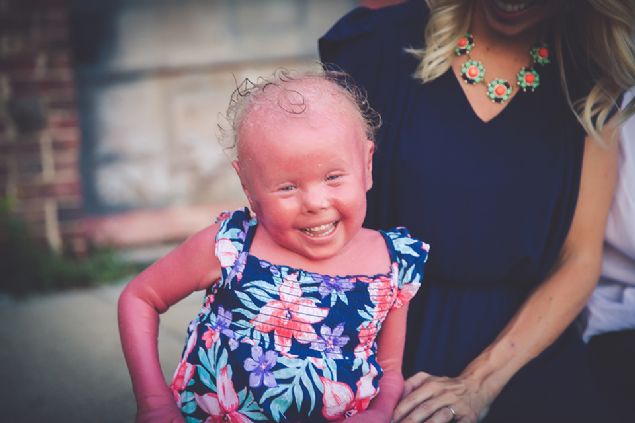 Ve ite kk kzn imdiki hali...      