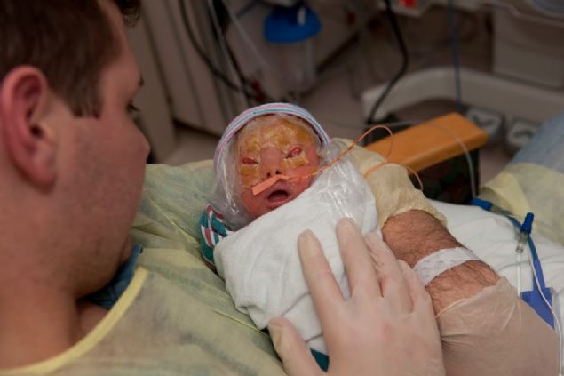 Ayrca vcudunda kzarklklar vard. Tedavisi olmayan hastaln ayn zamanda lmcl olduu biliniyor. Aile gerek kzlarn gerekse de kendilerini zorlu gnler beklediini biliyordu.  
