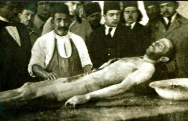 lmnn ardndan onun bedenini kadavra olarak kullanmak istediler; nk nl yazar hastanede kimse tanmyordu; bu yzden de sahipsiz bir l olduunu dndler.  