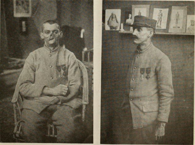  Ladd�in aralar�nda bulundu�u iki �� heykelt�ra� onlar� bu karanl�k ruh halinden kurtarabilmek ve onlar�n toplum i�inde rahat bir �ekilde dola�abilmesini sa�layabilmek i�in maskeler �retti.      