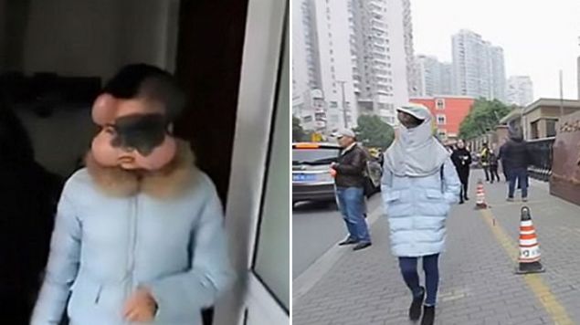  Doktorlar deri altna dzenli olarak enjeksiyon yoluyla drt kk top nakletti. Doum lekesi karldktan sonra kalacak olan bo alanlara bu dokular eklenecek' diye konutu. 