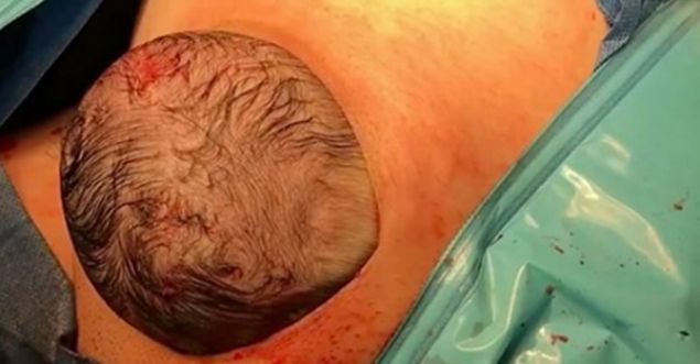   Bu bebek herkesi �a��rtt�. Do�um an� geldi�inde doktorlar�n bile beklemedi�i bir �ey oldu. Kimsenin olmas�n� istemedi�i bir �ekilde anne do�um s�ras�nda bayg�nl�k ge�irdi. �lk ba�ta ��phelenen doktorlar sadece bay�ld���n� ��renince �oke oldular.     