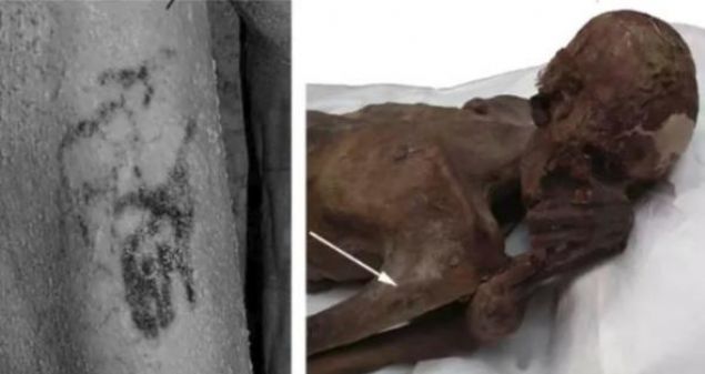 Kad�n�n, i�lem sonras� en az 1 hafta ya�ad��� san�l�yor. Hatta, kafatas�ndaki delinen b�lgede kemiklerde erken iyile�me belirtileri bile g�zleniyor.Mumyalara yeni bir teknik kullanarak yap�lan ba�ka bir incelemede de erkek mumyan�n �st kolunda vah�i bir bo�a ve bir koyun d�vmesi oldu�u g�r�ld�.     